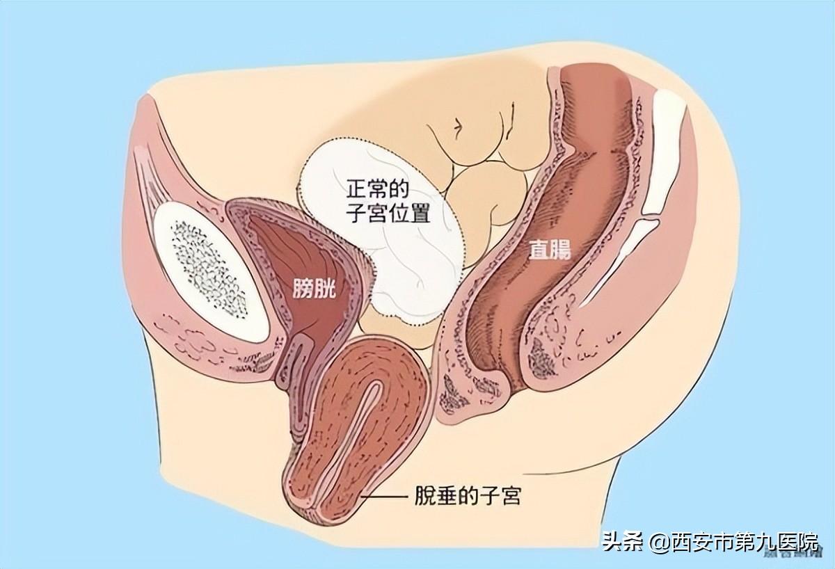睪丸下垂松弛的原因及治療方法，睪丸下垂松弛的原因與治療方法解析