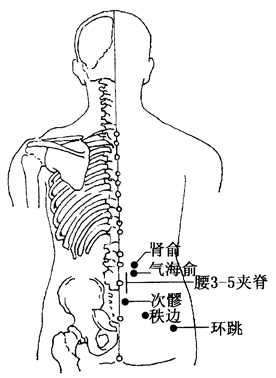 坐骨神經(jīng)痛的治療方法，哪種方式能最快緩解你的疼痛？，坐骨神經(jīng)痛快速緩解方法與治療方式探討