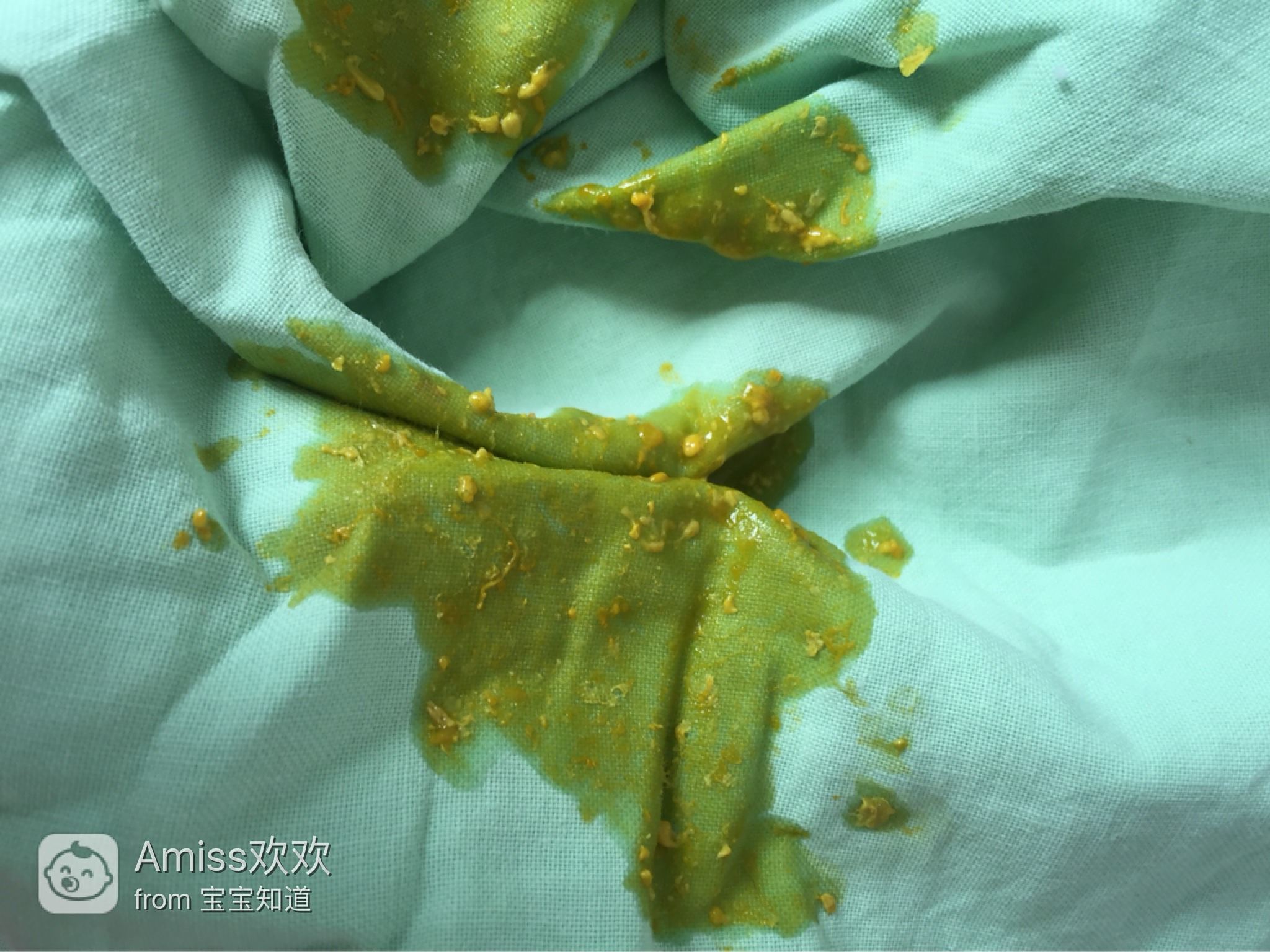 十來(lái)天的嬰兒老是拉稀怎么辦？全面解析寶寶腹瀉應(yīng)對(duì)之策，嬰兒腹瀉應(yīng)對(duì)指南，全面解析寶寶拉稀怎么辦？
