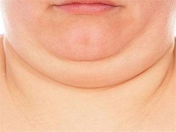 如何有效去除雙下巴贅肉——實(shí)用指南，實(shí)用指南，如何有效去除雙下巴贅肉