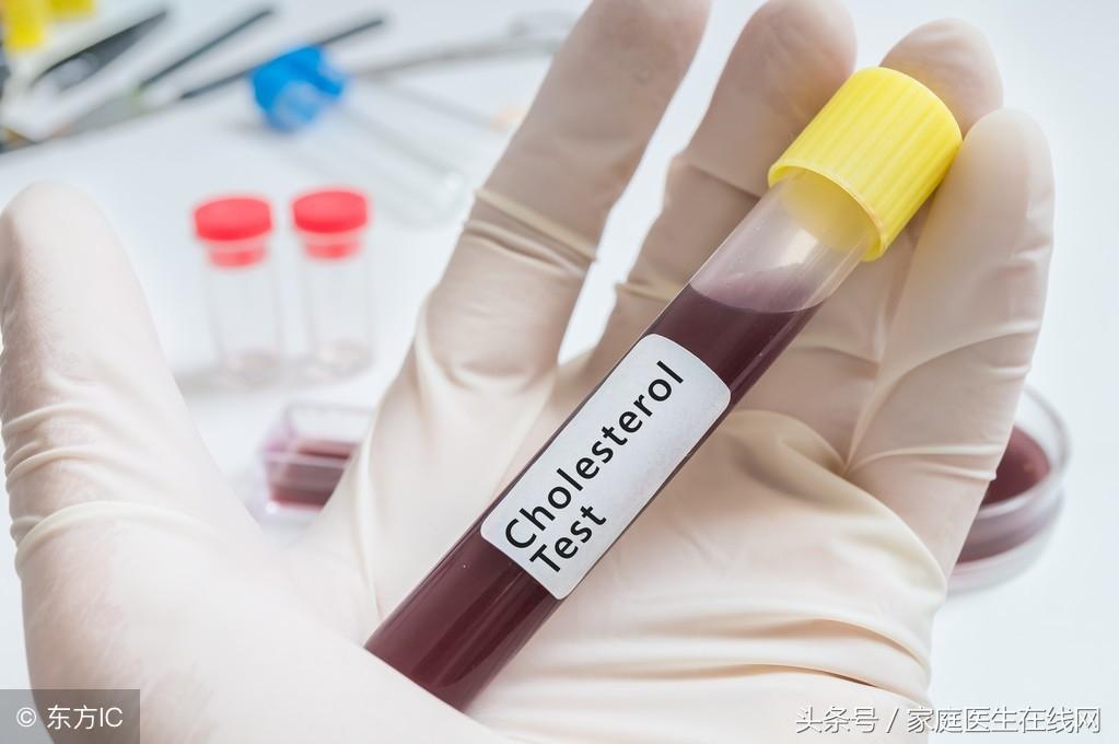 糖尿病的成因，深度解析其背后的原因，深度解析糖尿病成因，揭示背后原因真相