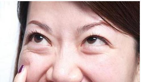 如何消除眼袋，方法與技巧詳解，消除眼袋的有效方法與技巧全解析